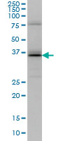 1 - UBE2J1 Antibody (monoclonal) (M01) AT4438a