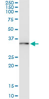 5 - UBE2R2 Antibody (monoclonal) (M01) AT4443a