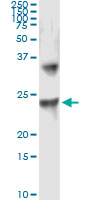 5 - UBE2T Antibody (monoclonal) (M01) AT4444a