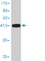 1 - UBE2T Antibody (monoclonal) (M01) AT4444a
