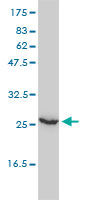 1 - UBE2T Antibody (monoclonal) (M01) AT4444a
