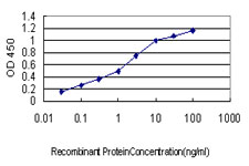 10 - UBR1 Antibody (monoclonal) (M01) AT4450a