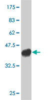 1 - UBR1 Antibody (monoclonal) (M01) AT4450a