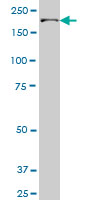 1 - UBR1 Antibody (monoclonal) (M01) AT4450a