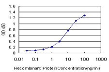 10 - UCKL1 Antibody (monoclonal) (M01) AT4457a