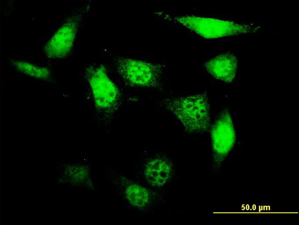 3 - UCKL1 Antibody (monoclonal) (M01) AT4457a