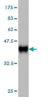 1 - UCKL1 Antibody (monoclonal) (M01) AT4457a