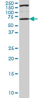 1 - UCKL1 Antibody (monoclonal) (M01) AT4457a