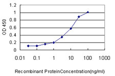 10 - ULK4 Antibody (monoclonal) (M01) AT4466a