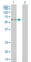 1 - ULK4 Antibody (monoclonal) (M01) AT4466a