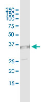 5 - UNC119 Antibody (monoclonal) (M01) AT4469a