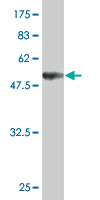 1 - UNC119 Antibody (monoclonal) (M01) AT4469a