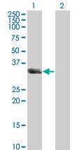 1 - UNC119 Antibody (monoclonal) (M01) AT4469a