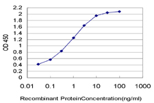 10 - UPK1B Antibody (monoclonal) (M02) AT4474a