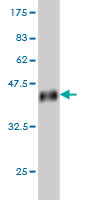 1 - UPK1B Antibody (monoclonal) (M02) AT4474a