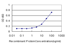 10 - UROS Antibody (monoclonal) (M01) AT4475a