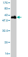 1 - UROS Antibody (monoclonal) (M01) AT4475a