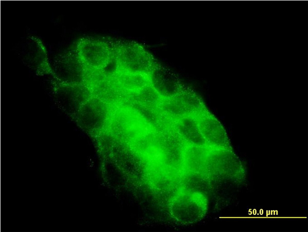 3 - USP31 Antibody (monoclonal) (M01) AT4486a