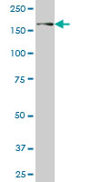 1 - USP31 Antibody (monoclonal) (M01) AT4486a