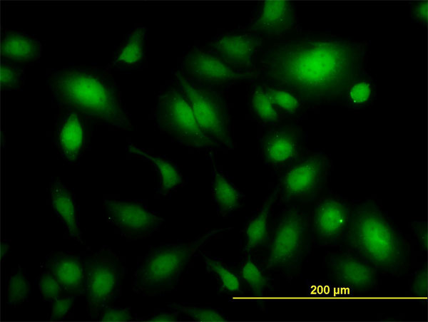 3 - USP34 Antibody (monoclonal) (M01) AT4488a
