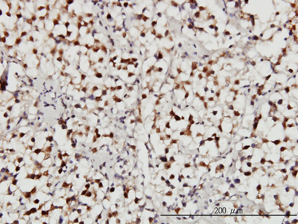 2 - USP34 Antibody (monoclonal) (M01) AT4488a