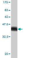 1 - USP34 Antibody (monoclonal) (M01) AT4488a