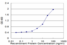 10 - USP9Y Antibody (monoclonal) (M05) AT4498a