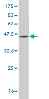 1 - USP9Y Antibody (monoclonal) (M05) AT4498a