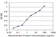 10 - VAMP1 Antibody (monoclonal) (M01) AT4499a
