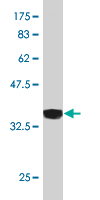1 - VAMP1 Antibody (monoclonal) (M01) AT4499a