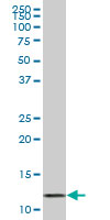 1 - VAMP1 Antibody (monoclonal) (M01) AT4499a