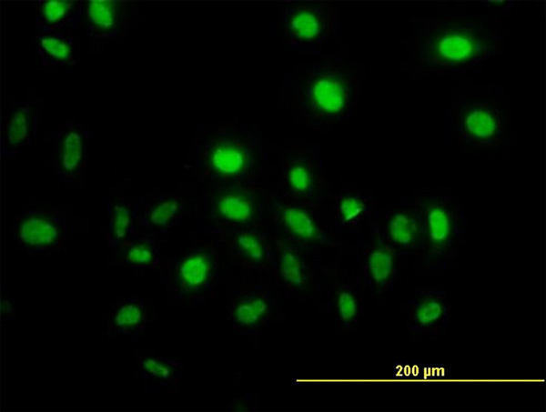 3 - VAV1 Antibody (monoclonal) (M01) AT4502a
