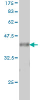 1 - VAV1 Antibody (monoclonal) (M01) AT4502a