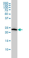 1 - VBP1 Antibody (monoclonal) (M01) AT4504a
