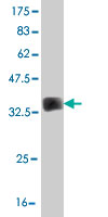 1 - VRK2 Antibody (monoclonal) (M01) AT4522a