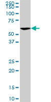 1 - VRK2 Antibody (monoclonal) (M01) AT4522a