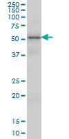 1 - VRK2 Antibody (monoclonal) (M01) AT4522a