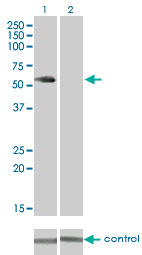 1 - VRK2 Antibody (monoclonal) (M01) AT4522a