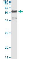 5 - WARS Antibody (monoclonal) (M02) AT4524a