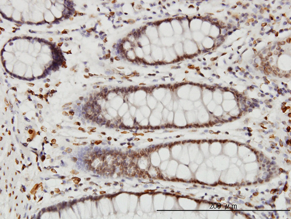 2 - WDR20 Antibody (monoclonal) (M02) AT4530a