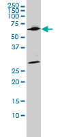 1 - WDR20 Antibody (monoclonal) (M02) AT4530a
