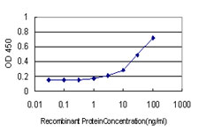10 - WDR4 Antibody (monoclonal) (M01) AT4531a