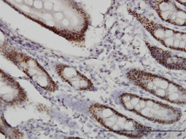 2 - WDR4 Antibody (monoclonal) (M01) AT4531a