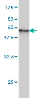 1 - WDR4 Antibody (monoclonal) (M01) AT4531a