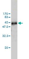1 - WDR6 Antibody (monoclonal) (M01) AT4535a