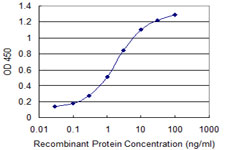 10 - WDR79 Antibody (monoclonal) (M04) AT4537a