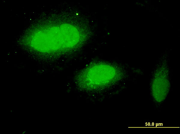 3 - WDR79 Antibody (monoclonal) (M04) AT4537a