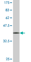 1 - WDR79 Antibody (monoclonal) (M04) AT4537a