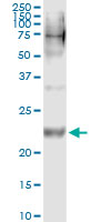 5 - WISP2 Antibody (monoclonal) (M09) AT4540a