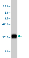 1 - WRB Antibody (monoclonal) (M04) AT4542a